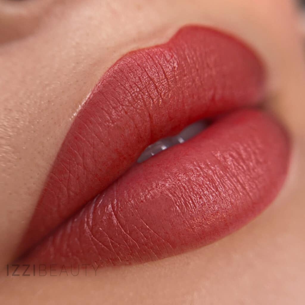 Nazorg PMU Lippen