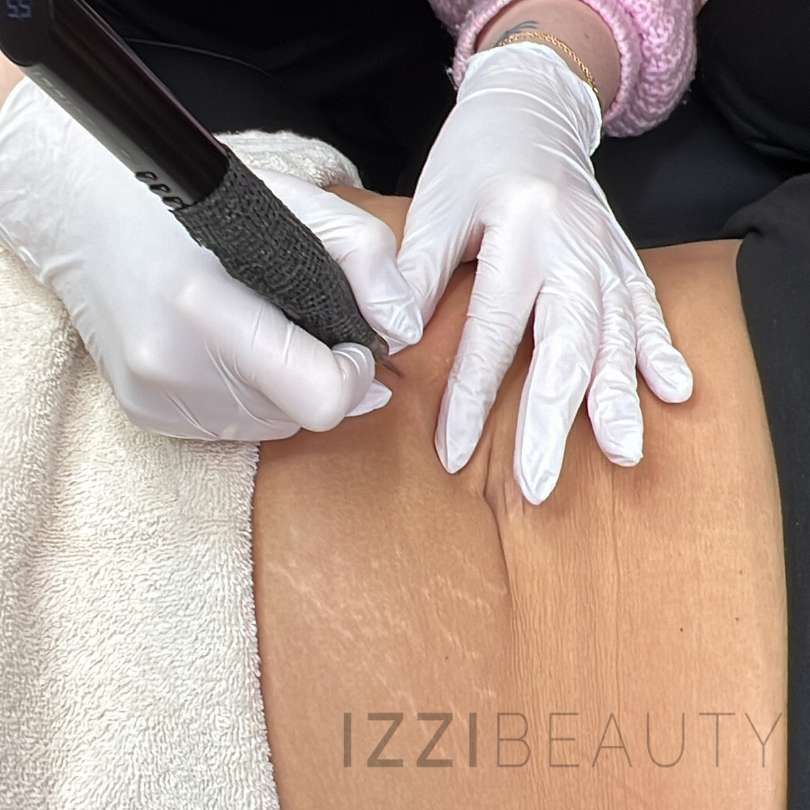 Inkless Stretch Mark opleiding IZZI